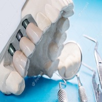 видове зъбни импланти - 1329 типа